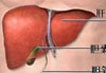 非酒精性脂肪肝病导致代谢紊乱患病率增高的队列研究