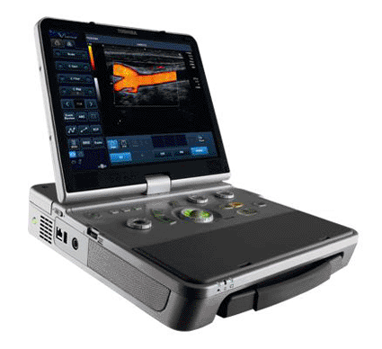 东芝Laptop超声系统为病人带来新型成像技术
