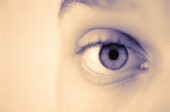 眼科检查或可能发现多发性硬化症