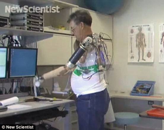科学家发明可用意念操控的假肢