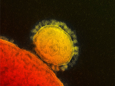 新型冠状病毒侵人机制有突破 但身世仍是谜