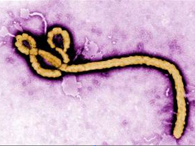 他汀类药物是感染埃博拉病毒患者的一个可行治疗方案