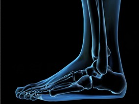 足医护理vs穿鞋建议传单发放对前脚痛的效果比较