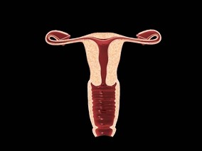 复发性卵巢癌患者进行来那度胺连续治疗的安全性和效果
