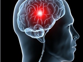 LEV可以更好的降低脑外伤患者的癫痫风险