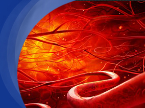 活动期癌症患者的静脉血栓栓塞复发和出血的预测因子