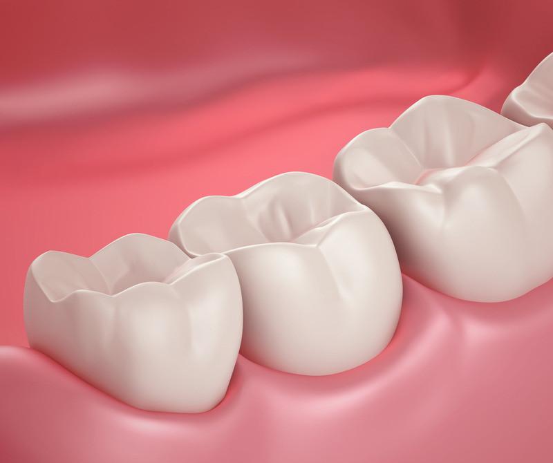 临床判断牙髓情况与组织学检查结果一致