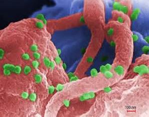 美研究揭示宿主蛋白与HIV-1衣壳结合过程