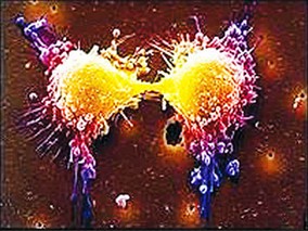 使用PPIs和沙门氏杆菌菌血症之间的关系：一个巢式病例对照研究