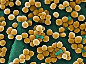 抗金黄色葡萄球菌β内酰胺类联合万古霉素可缩短MRSA菌血症持续时间