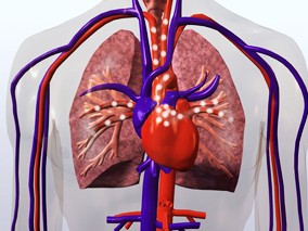 MMC诱导的肺静脉闭塞性疾病的预防