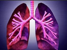 通路基因多态性可预测铂类和紫杉醇治疗晚期非小细胞肺癌的结局