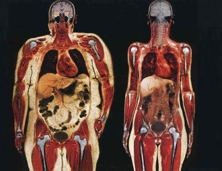 胖子和瘦子：细胞到体型的视觉差异
