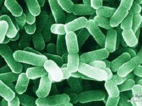 铜绿假单胞菌感染患者与不利短期治疗结局相关的风险因素