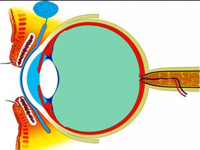 拉坦前列素治疗开角型青光眼有效