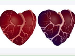 冠状动脉CT血管造影：“双低”碘克沙醇方案优于标准碘普罗胺方案