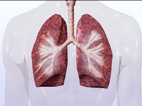 EGFR基因突变和临床特征对使用EGFR TKIs治疗的肺癌患者结局的影响