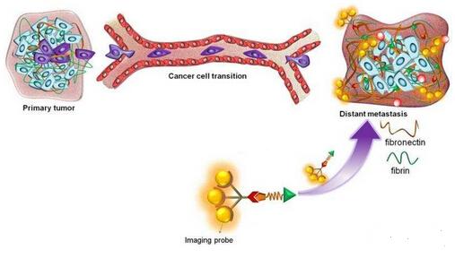 Nat Comms：定位乳腺癌复发早期和微转移