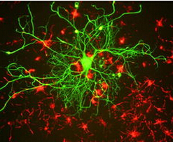 这7种神经科特征性脑影像资料，你知道吗？