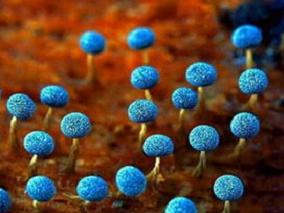 侵袭性真菌感染：脂质体两性霉素B能降低肾毒性