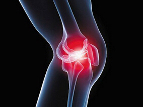 膝骨关节炎疼痛治疗：硫酸软骨素+盐酸氨基葡萄糖vs塞来昔布