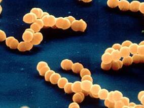 如何降低碳青霉烯耐药肠杆菌对虚弱病人的影响？