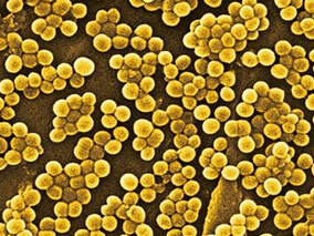 耐甲氧西林金黄色葡萄球菌肺炎的全球倡议