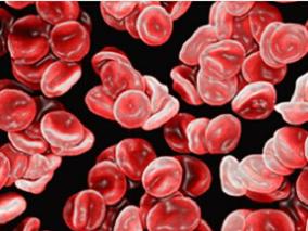 镰状细胞性贫血儿童TCD血流速度的维持：羟基脲vs标准输血