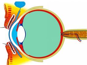 临床指南网络meta分析：开角型青光眼一线治疗