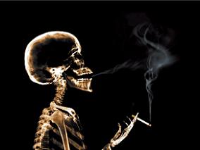 吸烟增加蛛网膜下腔出血风险 重度吸烟女性尤甚