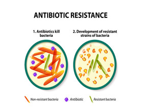 抗菌药管理能降低抗菌药耐药的细菌感染率和定植发生率？