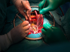 心脏静脉狭窄患者手术一波三折 电极导线断裂怎么办？