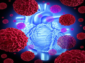 罕见的心脏嗜铬细胞瘤在诊治上有何特殊性？