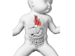 婴儿心脏扩大合并室壁瘤 如何诊断和治疗？