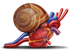 PCI术中发现冠状动脉慢血流 怎样处理避免复发胸痛？