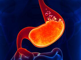 幽门螺杆菌感染或增加胃肠道癌症化疗诱导的呕吐
