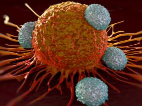 新研究解开“免疫治疗对膀胱癌束手无策”之谜