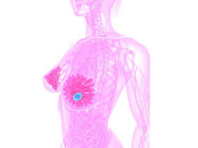 新激素类药物阻止乳腺癌生长 或成一线疗法