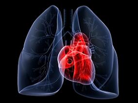 慢性肺源性心脏病出现全心衰竭和房颤 如何用药学问大