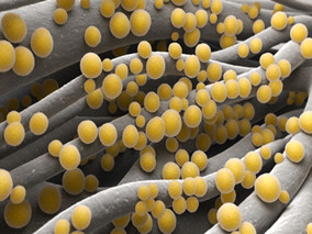 电子鼻“开疆扩土” 鉴别引发感染的超级细菌