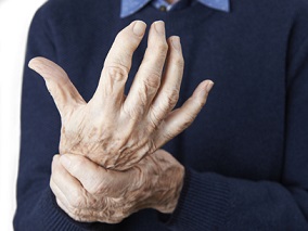 手骨关节炎镇痛治疗 羟氯喹能否被寄予厚望？