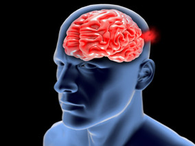 降压药对脑小血管病有何影响？