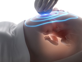 妊早期 医生能安心使用阴道抗真菌药吗？