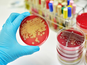 黄晓军所长：造血干细胞移植后侵袭性真菌病研究进展