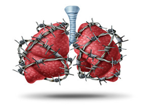 尼达尼布对特发性肺纤维化的长期疗效如何？