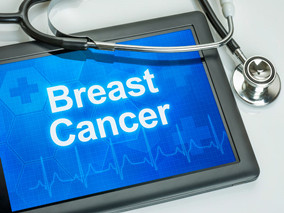 早期HER-2阳性乳腺癌患者：曲妥珠单抗宜早不宜晚？