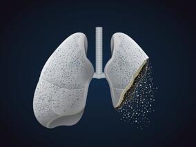 支修益教授：肺癌流行病学现状与病因分析