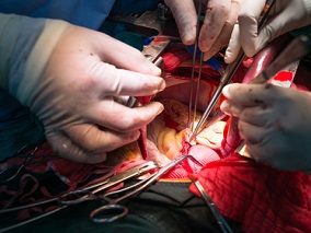 经导管主动脉瓣置换术后 可影响死亡率的因素有哪些？