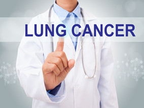 肺癌患者戒烟 获益或超化疗？