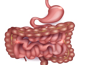 高龄患者使用乙烯磺酸钠 需警惕严重不良胃肠道事件